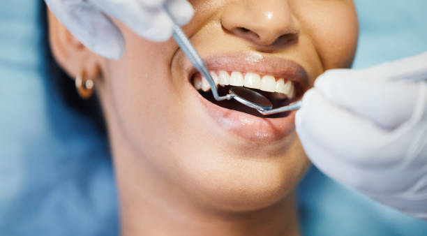 Best Broken or Chipped Tooth Repair in La Feria, TX