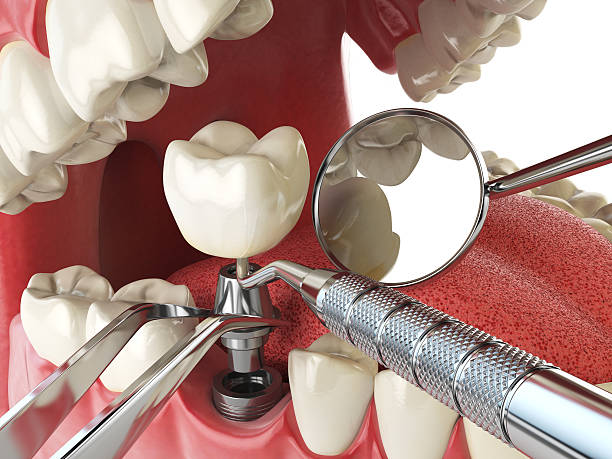 Best Broken or Chipped Tooth Repair in La Feria, TX